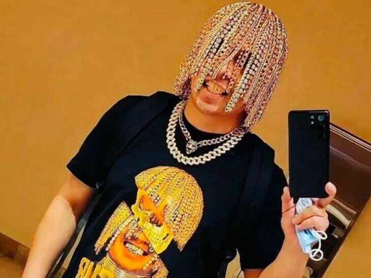 Rapper Dan Sur with chains implanted on his scalp 