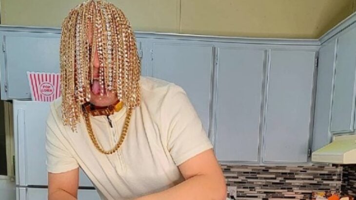 Rapero Dan Sur con cadenas implantadas en el cuero cabelludo 