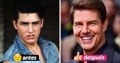 13 Famosos que cambiaron por completo al pasar por el dentista