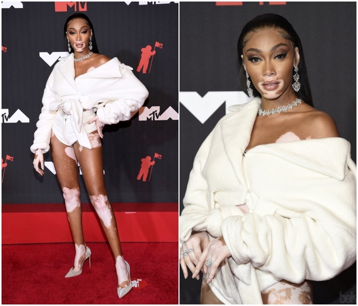 Winnie Harlow