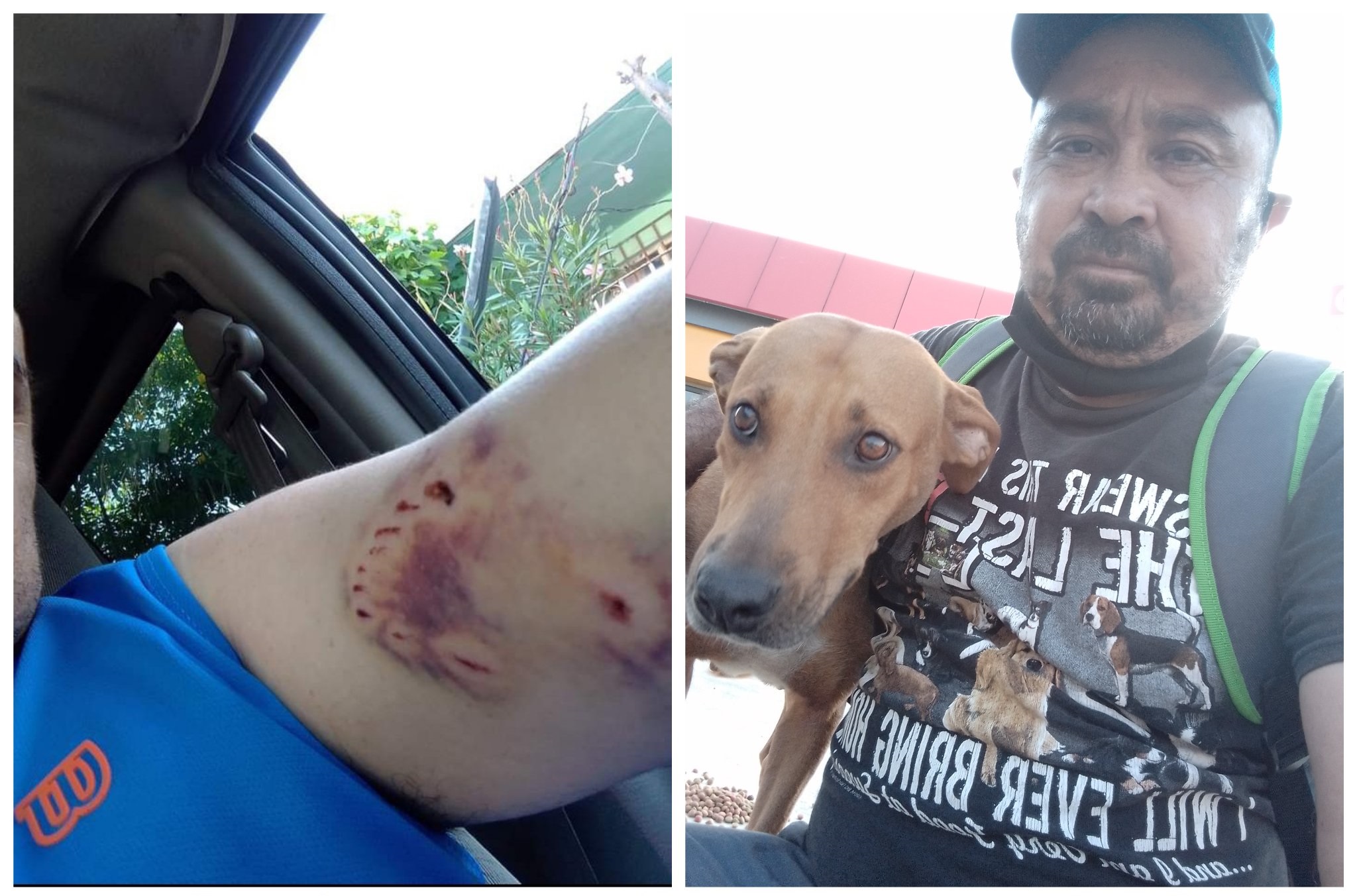 Mordida de perro; Perrita callejera le muerde un brazo y ahora le lleva comida todos los días