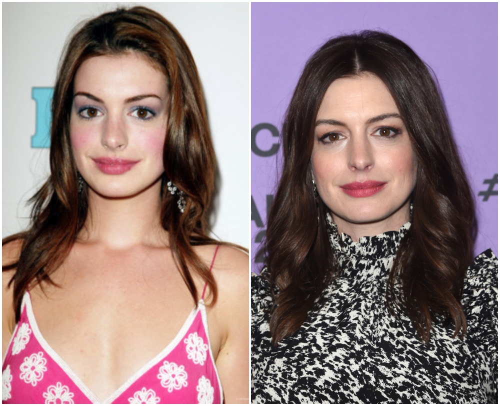 Anne Hathaway; 16 Proofs That Eyebrows Are The Frame Of Your Beauty