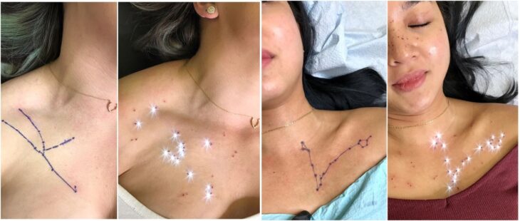Pecas falsas en el pecho; Las personas están tatuando constelaciones en sus rostros con pecas falsas 