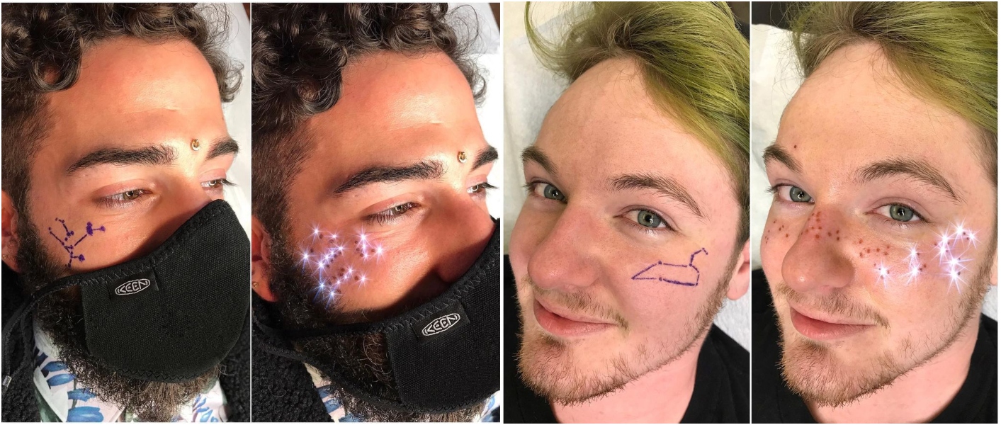 Boys with fake freckles;  People are tattooing constellations on their faces with fake freckles 