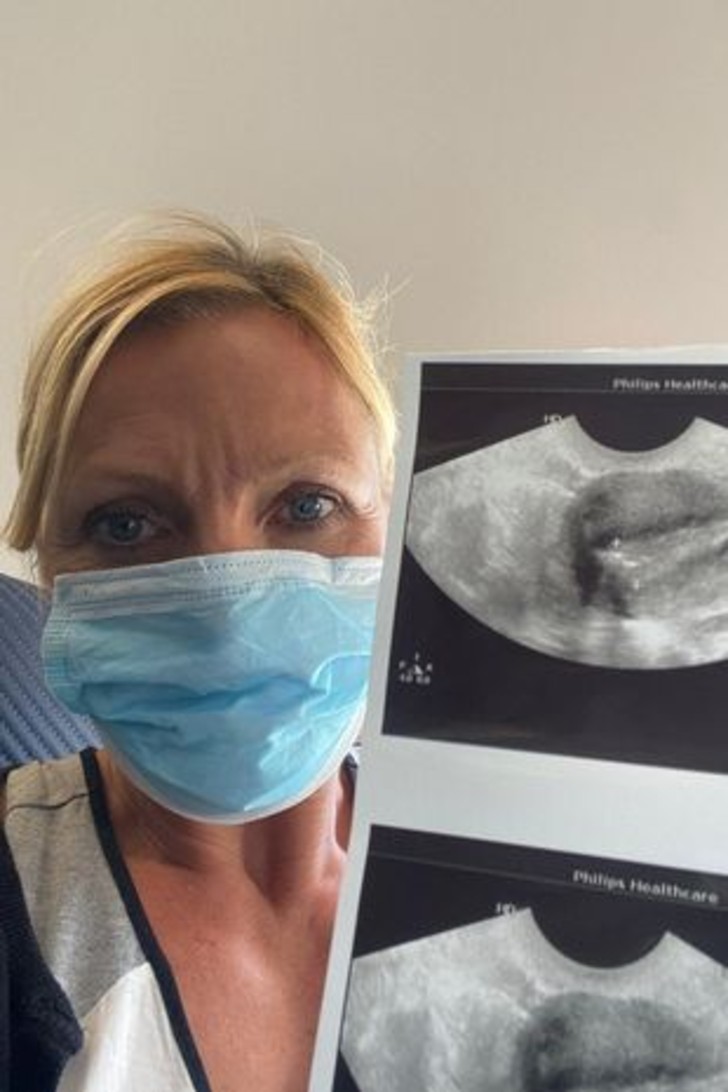 51 year old woman showing her ultrasound image