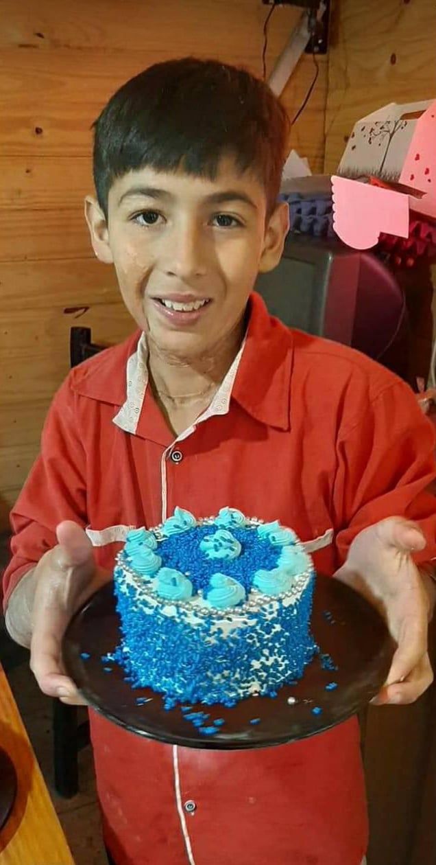 Niño vende pasteles para pagar su operación de piel 