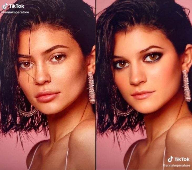Kylie Jenner antes y después de sus cirugías 