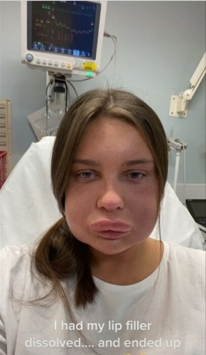 swollen face of a girl in a hospital 