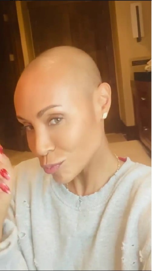 Jada Pinkett in the capture of her video talking about her alopecia process 