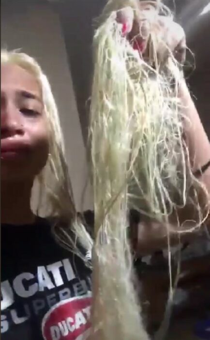 chica llorando mostrando como se le cae el cabello a montones