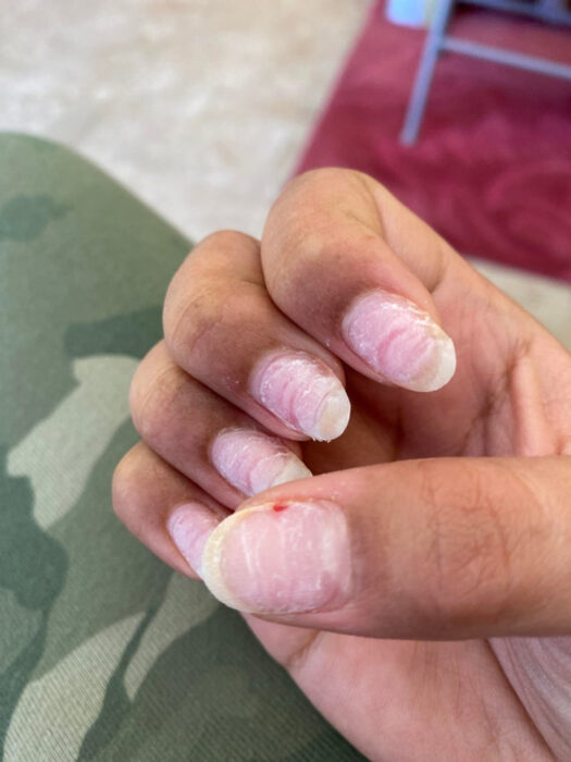 manicura mal realizada ;14 Mujeres que se arrepintieron de ir al manicurista