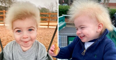 Locklan, el bebé que tiene un raro síndrome que impide que peinen su cabello