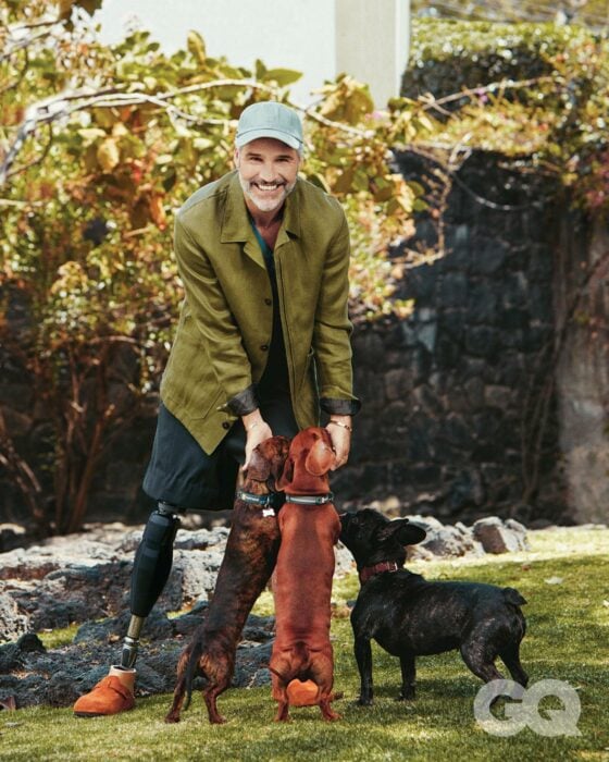Juan Pablo Medina con su prótesis rodeado de sus perros 