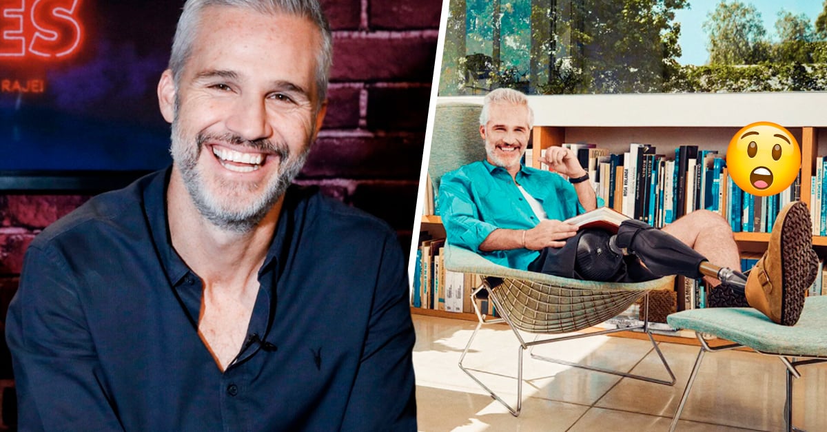 Juan Pablo Medina reappears and poses for the first time with his prosthesis for a magazine
