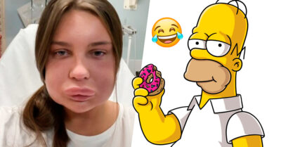 TikToker se quita el relleno de sus labios, termina en el hospital y la comparan con Homero