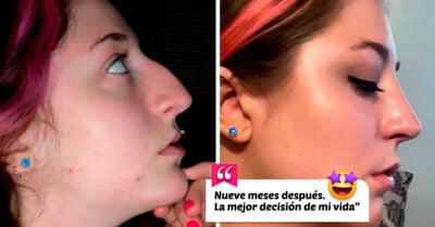 15 Personas que se sometieron a una cirugía plástica para darle un plus a su belleza