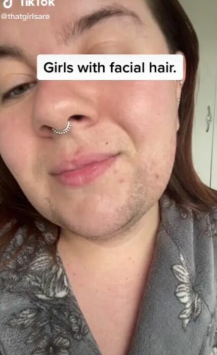 screenshot of a TikTok video showing a girl with facial hair on her chin 