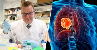 Científicos descubren célula inmune, capaz de destruir la mayoría de los tipos de cáncer