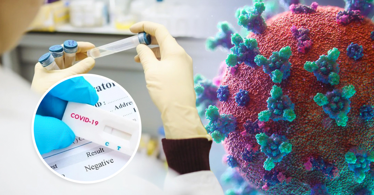Scientists create urine test to detect antibodies against covid-19