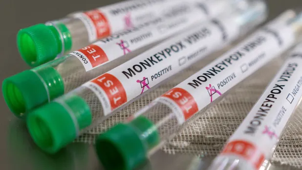 Detectan primer caso de viruela del mono en méxico