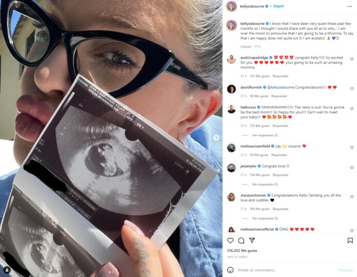 Kelly Osbourne announces her pregnancy