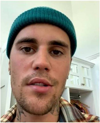 Justin Bieber frozen face 