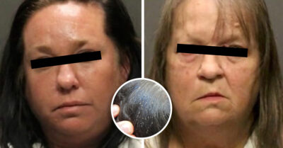 Niña de 9 años muere de anemia provocada por masiva infestación de piojos