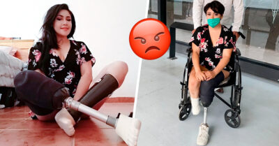 Amputaron por error sus piernas y así piensa el IMSS “reparar” su terrible error
