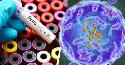 Nueva York reporta el primer caso de poliomielitis en EE. UU. en casi una década