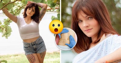 ¡Qué ofertón! Fue por una reducción de senos y salió del quirófano con implantes y una lipo