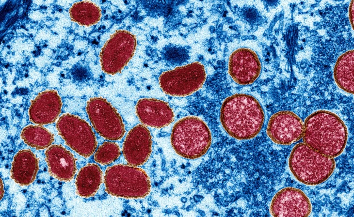 Virus de viruela símica