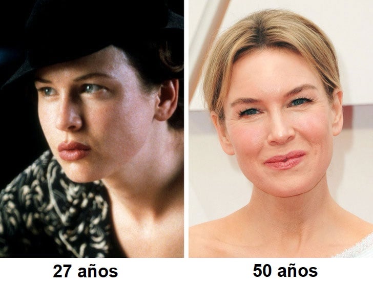 Renée Zellweger antes y después