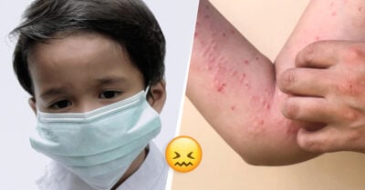 Gripe del tomate: el nuevo virus que apareció en la India y afecta principalmente a niños