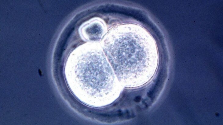 vista de un embrión desde un microscopio