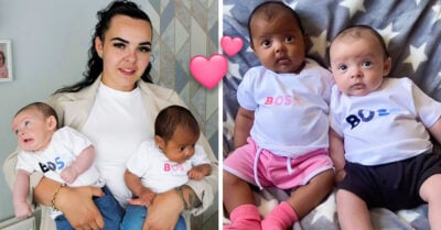 Una posibilidad entre un millón: Mamá da a luz a mellizos de diferente tono de piel