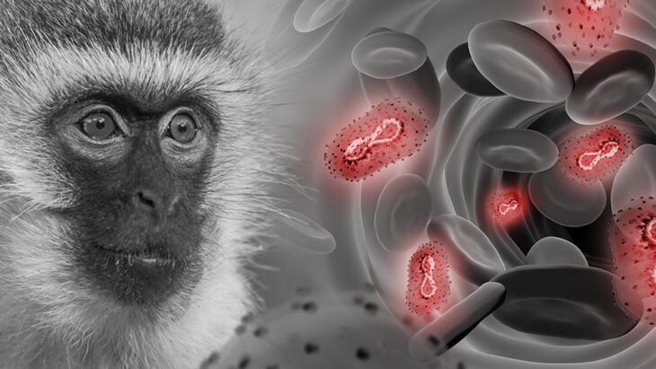 Nueva York declara estado de emergencia por la viruela del mono