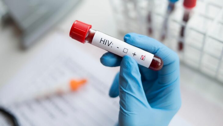 mano con guante sosteniendo una muestra de sangre para hacer el test del VIH