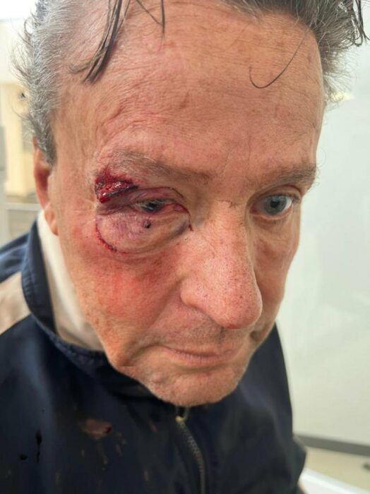 Foto que muestra la cara de Alfredo Adame golpeado 