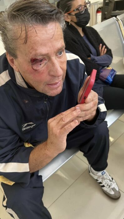 Alfredo Adame golpeado sentado en una silla en el hospital