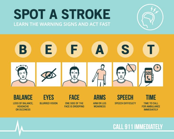 Be Fast acrónimo para detectar un derrame cerebral 