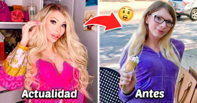 Solo tiene 23 años y ya se gastó más de 50 mil dólares en cirugías plásticas