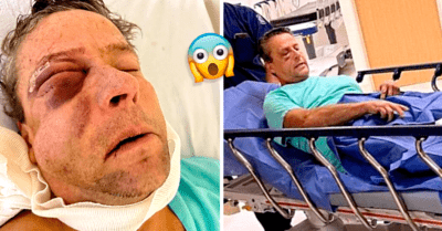 Alfredo Adame fue operado de emergencia tras daño en el ojo que le dejó la reciente golpiza