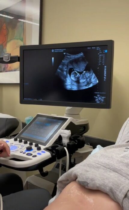 imagen que muestra el ultrasonido de una chica estudiante de medicina 