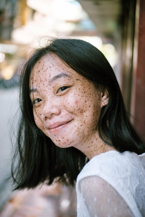 imagen de una niña con la cara llena de pecas 