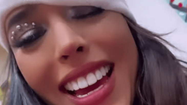 Mexican star Danna Paola with a white bandage on her head and a smile 