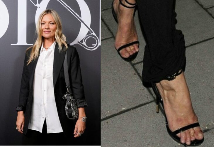 Kate Moss pies feos