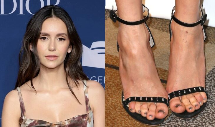 Nina Dobrev ugly feet