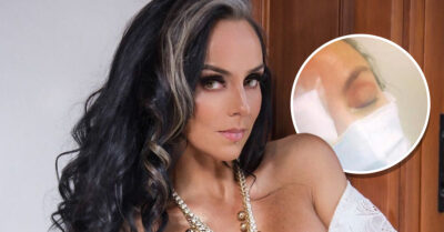 Ivonne Montero sufre fatal accidente en los ojos; perdió la visión