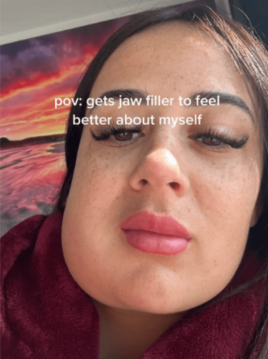 a girl shows her deformed jaw after an aesthetic procedure she has one side of her face completely swollen