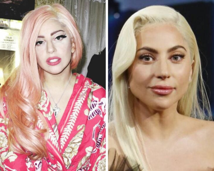 lady gaga before and after
